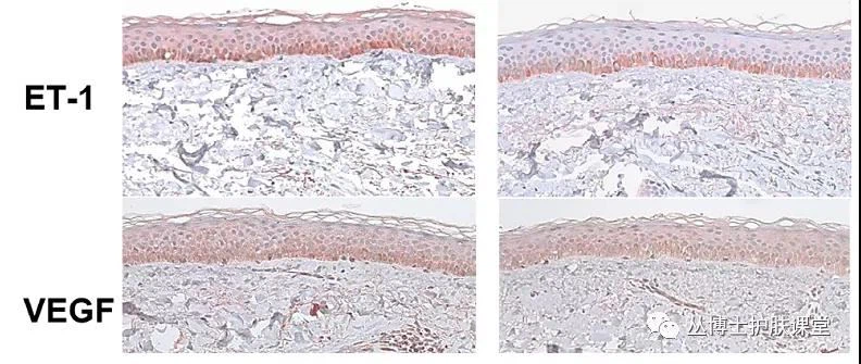 TXC inhibit the formation of new blood vessels
